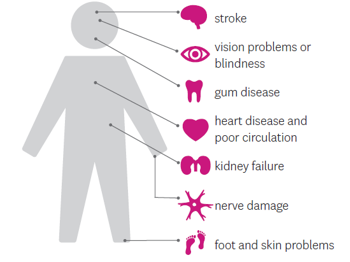 Complications from Diabetes